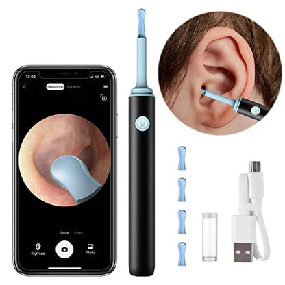 RYAAS STORE™  - PROFESSIONAL EAR WAX REMOVAL TOOL